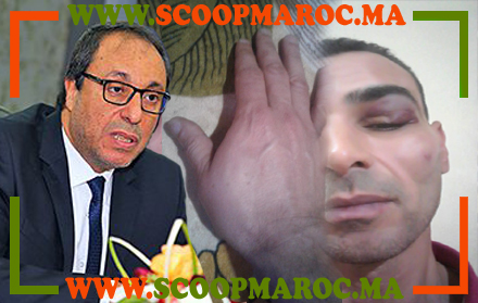 ترمضينة داخل مديرية التجهيز بسطات.. رئيس مصلحة يشرمل موظفا ويرسله للمستعجلات